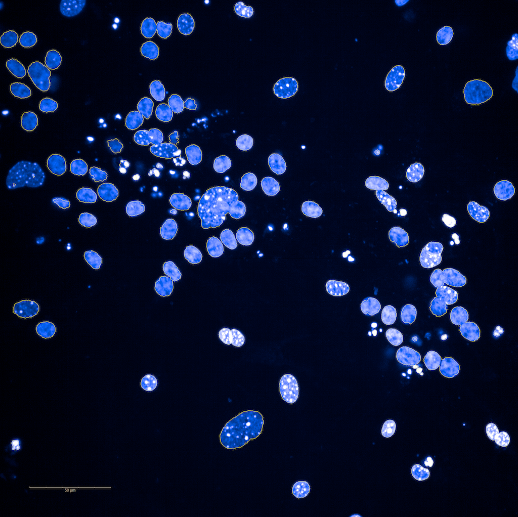 Image Segmentation for Nuclei Count